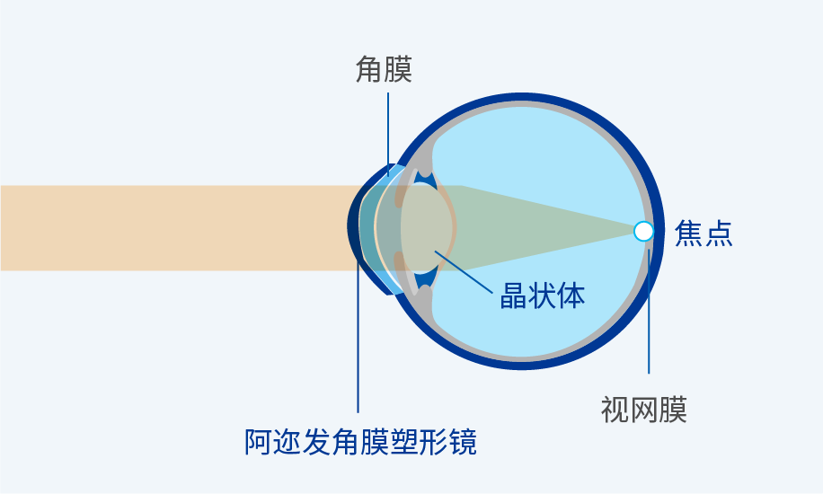图：配戴中