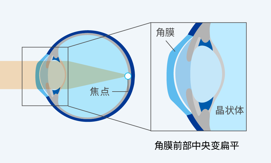 图：配戴后